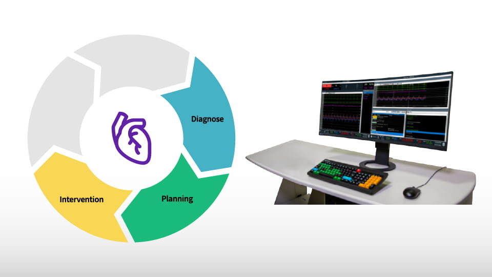Image-guided Cardiac Ablation